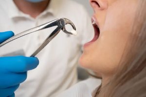 wisdom teeth removal near me - wisdom teeth professionals - sydney