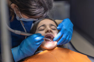 Wisdom Teeth Removing by an expert dentist in Sydney