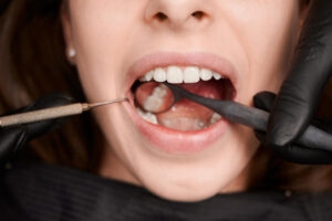 Dentist examining patient’s teeth with dental mirror and probe during oral checkup